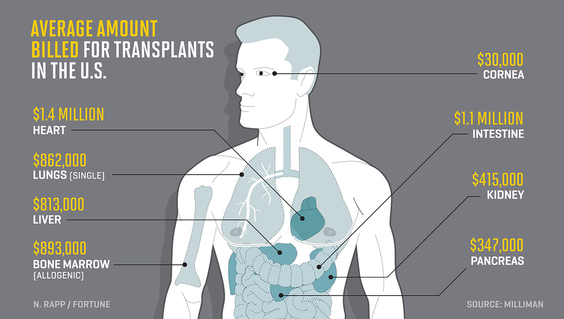 Image result for organ transplant costs