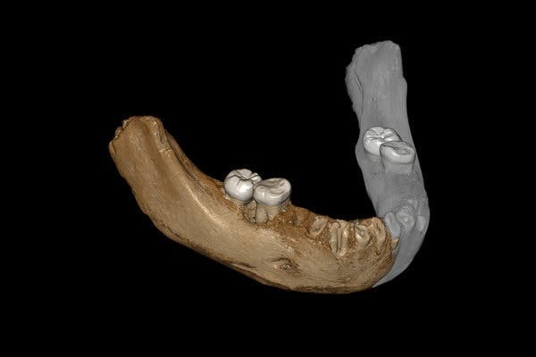 A virtual reconstruction of the Tibetan jaw in which an adhering crust was digitally removed. 