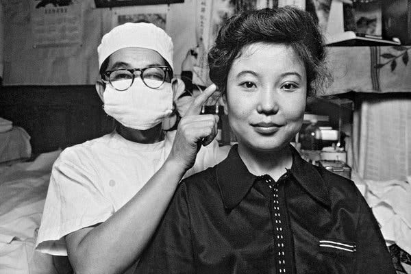 Dr. Fu Nongyu pointing to the eyes of a patient who had plastic surgery to get double eyelids, a feature more common in Western cultures. Beijing, 1980.