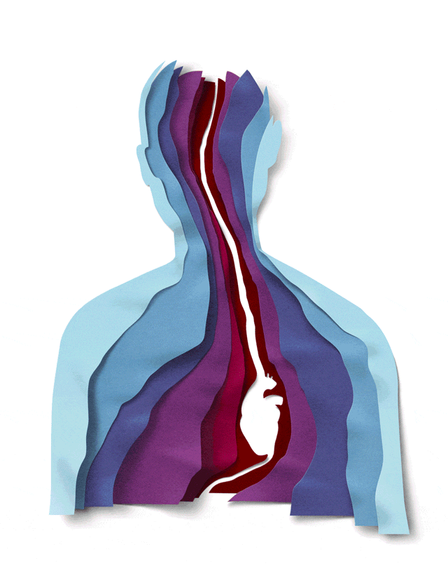 New York Times Sunday Review cover, animation for "Life After a hear Attack at Age 38" New York Times Sunday Review cover, animation for "Life After a hear Attack at Age 38"