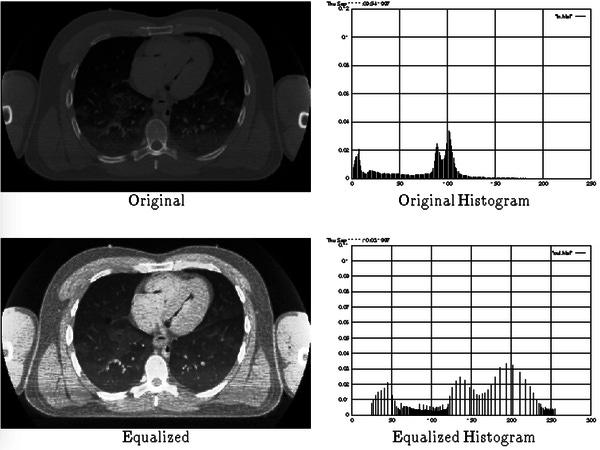 Image Augmentation for Deep Learning using Keras and Histogram Equalization Image Augmentation for Deep Learning using Keras and Histogram Equalization