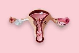 Image result for endometriosis